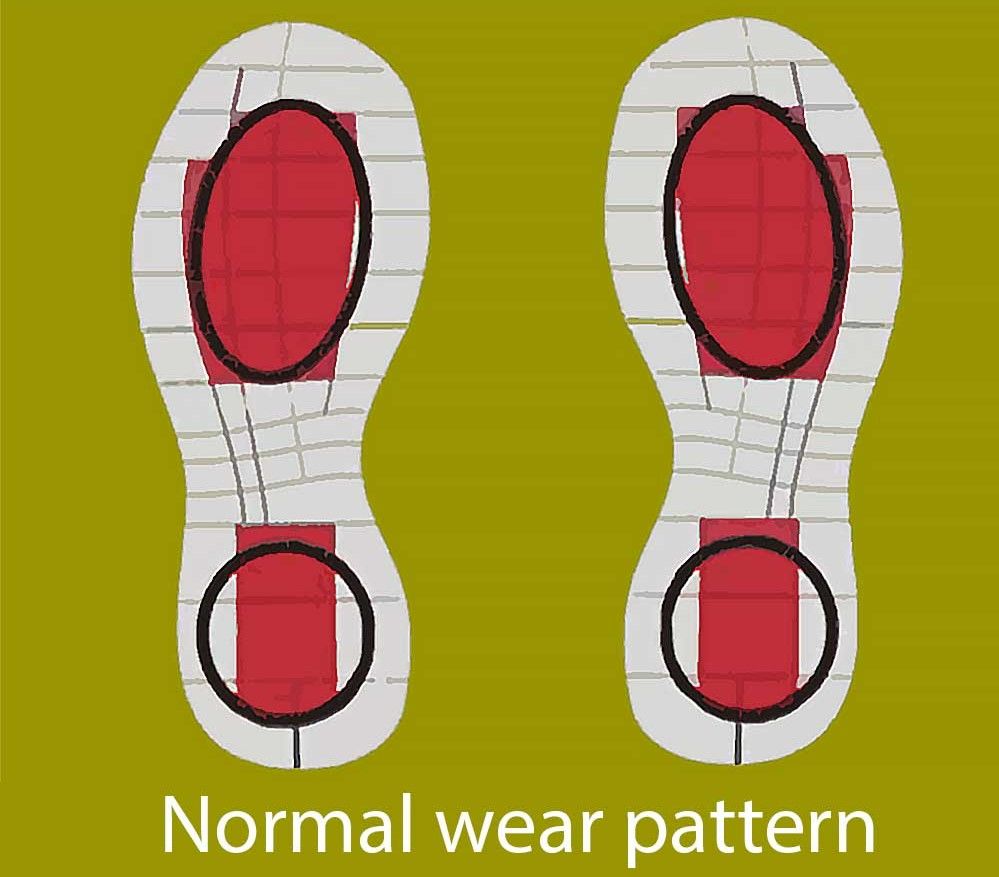 Kiểu đế giày bình thường sẽ bị mòn ở phần giữa